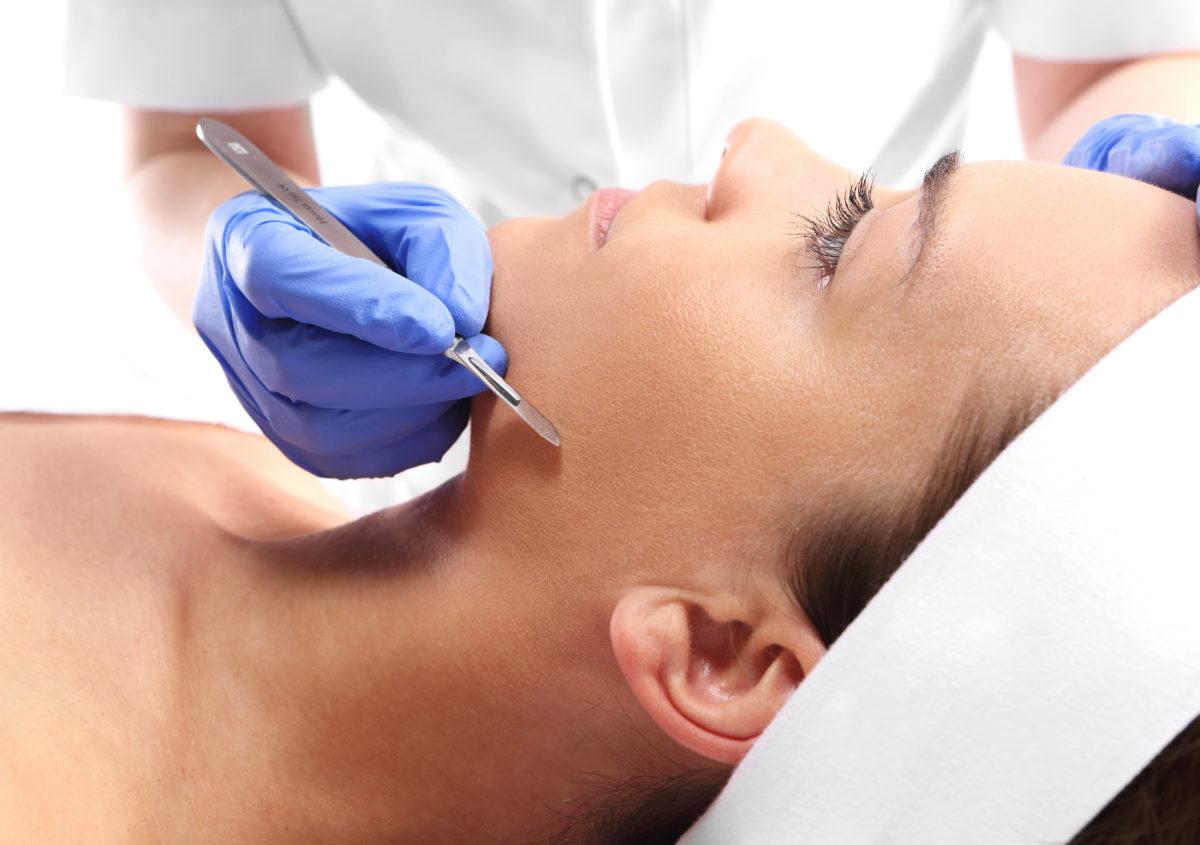 dermaplaning-houston dermaplaning houston e1521584816747